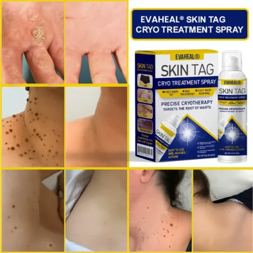 EvaHeal® SKIN TAG CRYO TREATMENT SPRAY - Image 2
