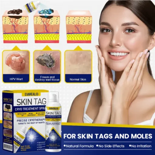 EvaHeal® SKIN TAG CRYO TREATMENT SPRAY - Image 3